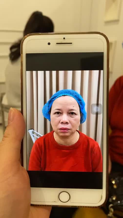 Cô khách hàng thực hiện THAY DÁNG MÀY - ĐỔI MÀU MÀY tại Thẩm mỹ DrD. Hiện tại cô đang được thiết kế dáng mày! Cả nhà gặp cô 1 chút nhé!