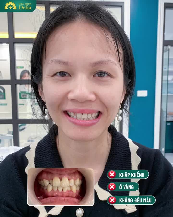 Chị gái và gia đình bên nội ai cũng muốn mình vào Vinh làm răng để thuận tiện đi lại.