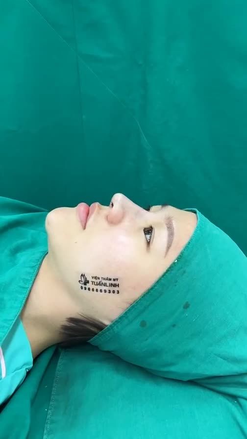 Case mũi cấu trúc vừa hoàn thành