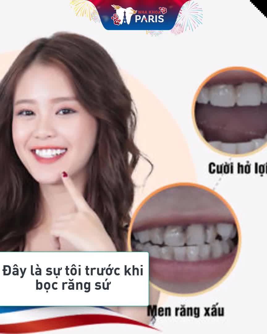 BOC RĂNG SỨ - ĐIỀU CHƯA TIẾT LỘ CỦA DIỄN VIÊN TRÂM NGÔ