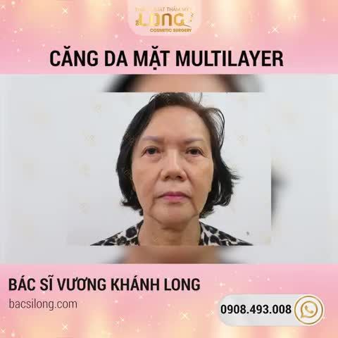DỨT ĐIỂM TÌNH TRẠNG: DA NHĂN - CHẢY XỆ - LÃO HÓA DA  DA MỊN - CĂNG MƯỚT - TÁI TẠO LÀN DA TỪ SÂU BÊN TRONG
