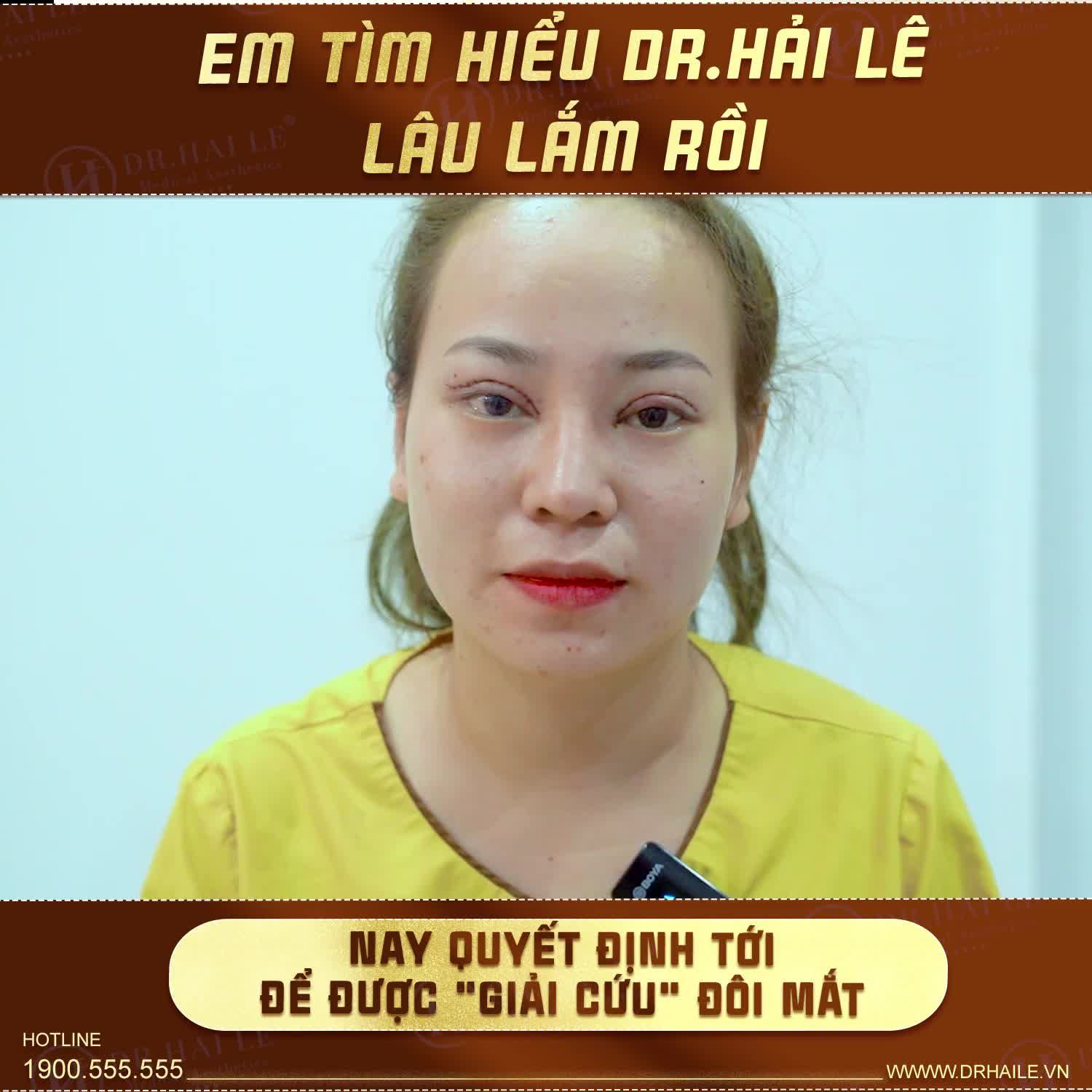 Lí do khách hàng tin tưởng lựa chọn sửa mí tại Dr.Hải Lê - Sài Gòn là đây.