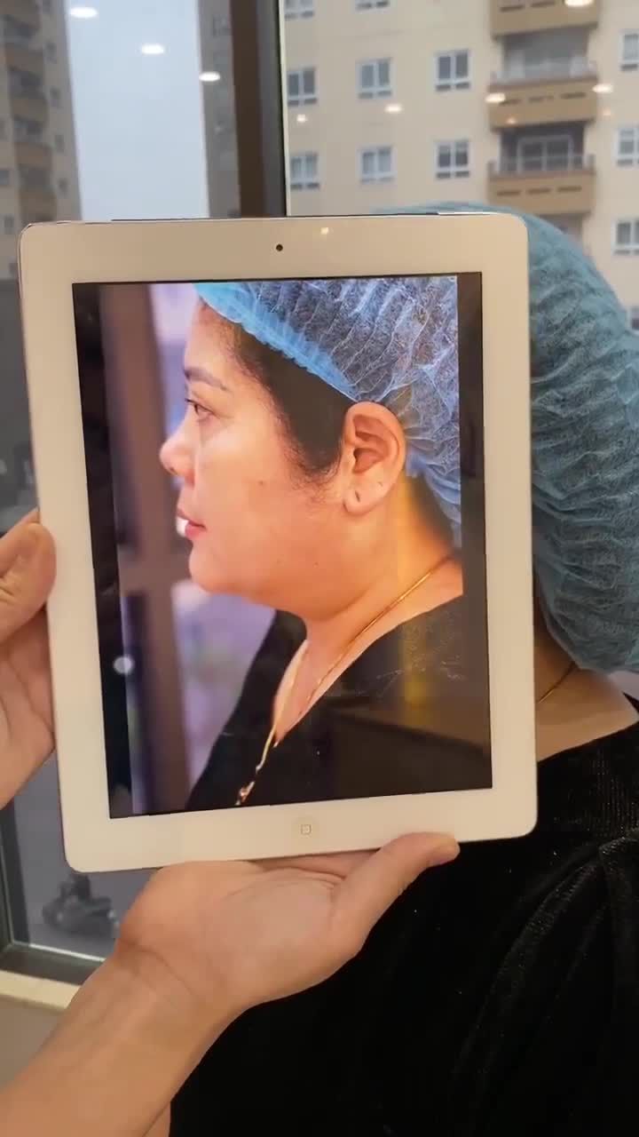 Tiêm tai tài lộc thực hiện nhẹ nhàng, đẹp ngay sau làm