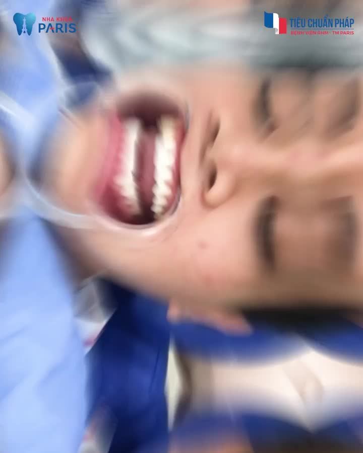 CHỈNH RĂNG - HÀM MẶT CHUẨN BỆNH VIỆN