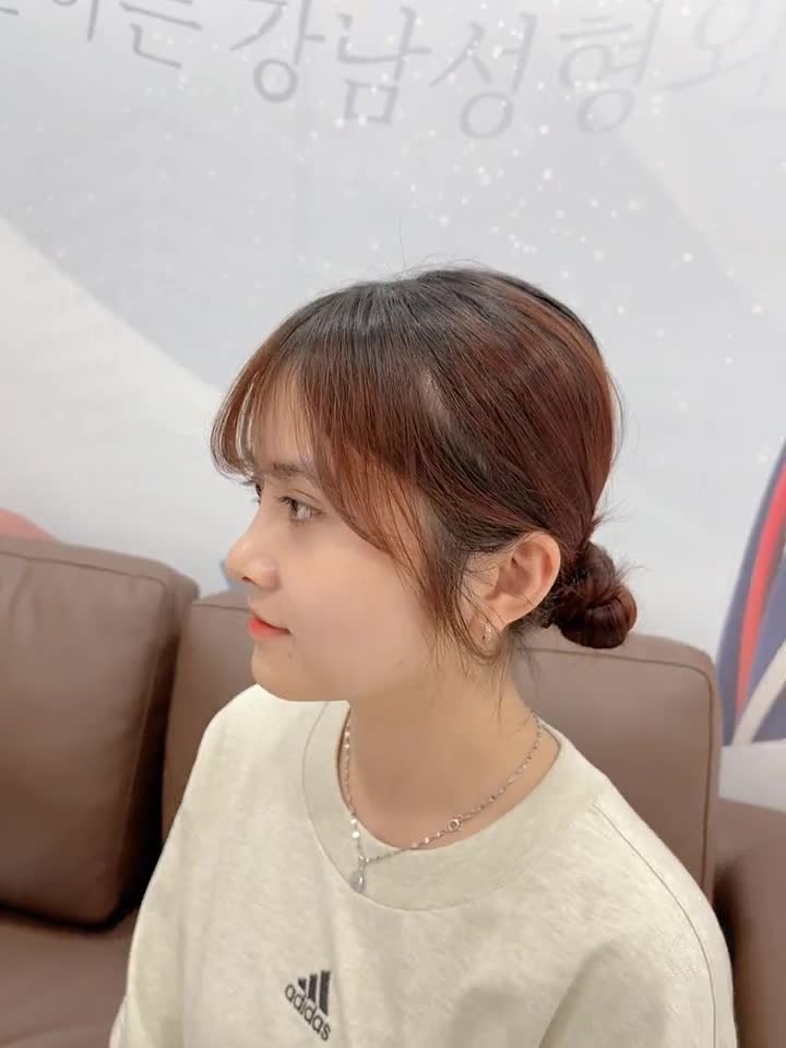 Nâng mũi đẹp và tự nhiên ở đâu? Top 1: Kangnam nha quý vị!