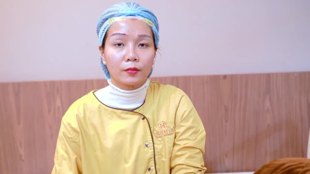 Nâng cung mày trên khắc phục tình trạng sụp mí + khoảng cách mắt và mày quá gần giúp vị khách hàng sở hữu khuôn mắt thanh thoát như thế nào? theo dõi ngay