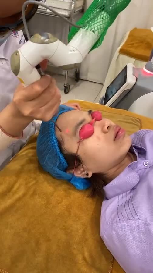 Khách hàng đang điều trị tàn nhang trên da. Mời cả nhà xem 1 chút quá trình bắn laser nhé.