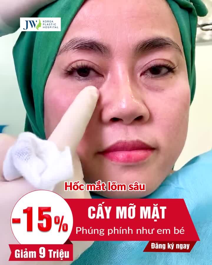 Cấy mỡ Baby Face: Giải pháp dành cho U40-U60 Trẻ từ 10-20 tuôi