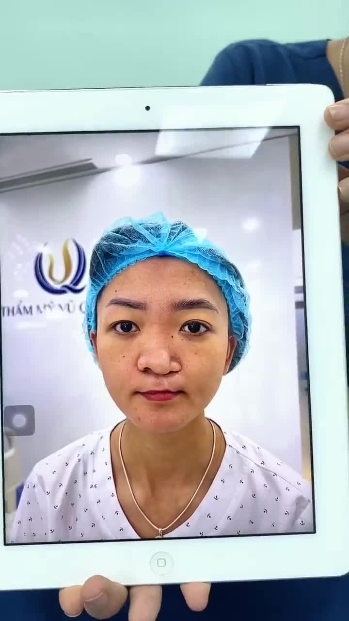 Số đặc biệt: tài trợ KH sứt môi hở hàm ếch thực hiện thay đổi ngoại hình.