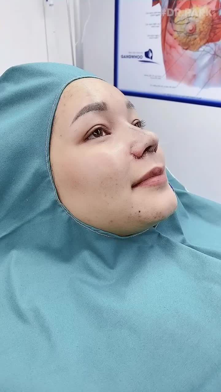 NÂNG MŨI CẤU TRÚC CHINH PHỤC ĐƯỢC KHÁCH HÀNG, VÌ SAO THẾ?