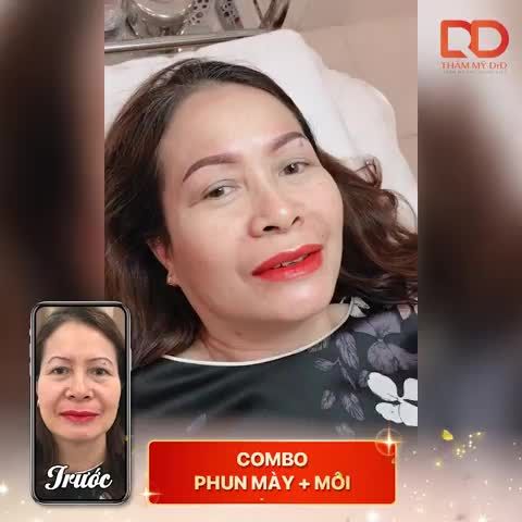 COMBO PHUN MÀY, PHUN MÔI TẠI DRD - KHÁCH HÀNG REVIEW KẾT QUẢ.