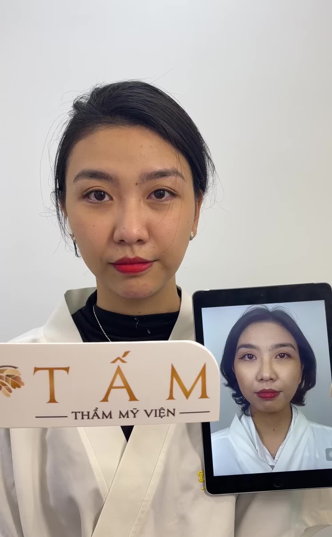 Ca Vline Perfect quay lại tái khám tại TMV Tấm
