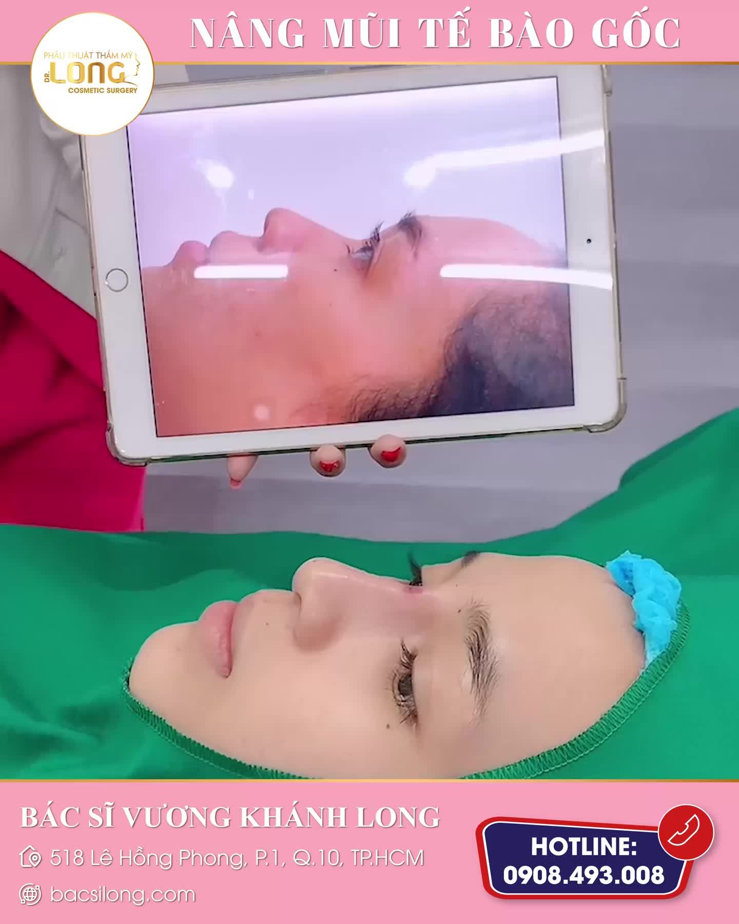 TẶNG DÁNG MŨI XINH TẠO NÊN VALENTINE NHÂN 2 HẠNH PHÚC