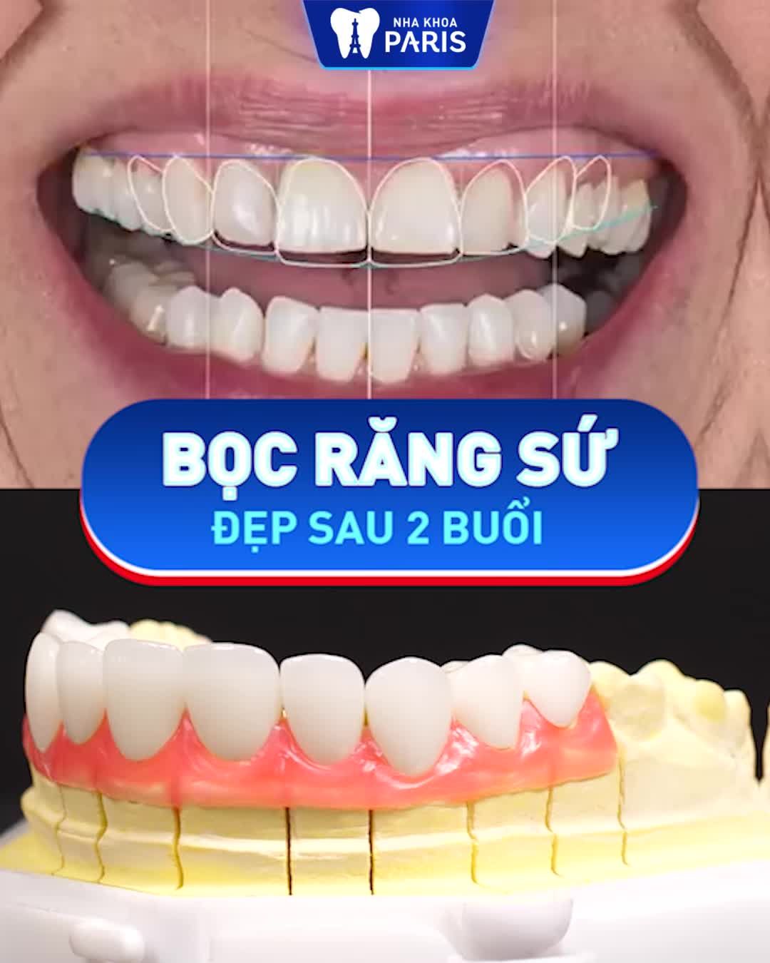 Răng nhiễm màu Hô Thưa kẽ Sứt mẻ