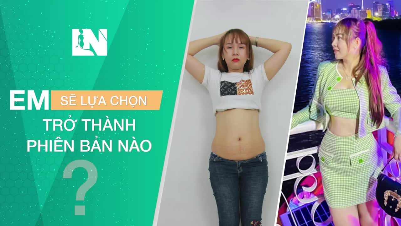 Chị Bích Châu (34 tuổi) đã sinh 2 bé khi quyết định thực hiện  hút mỡ tạo dáng thẩm mỹ