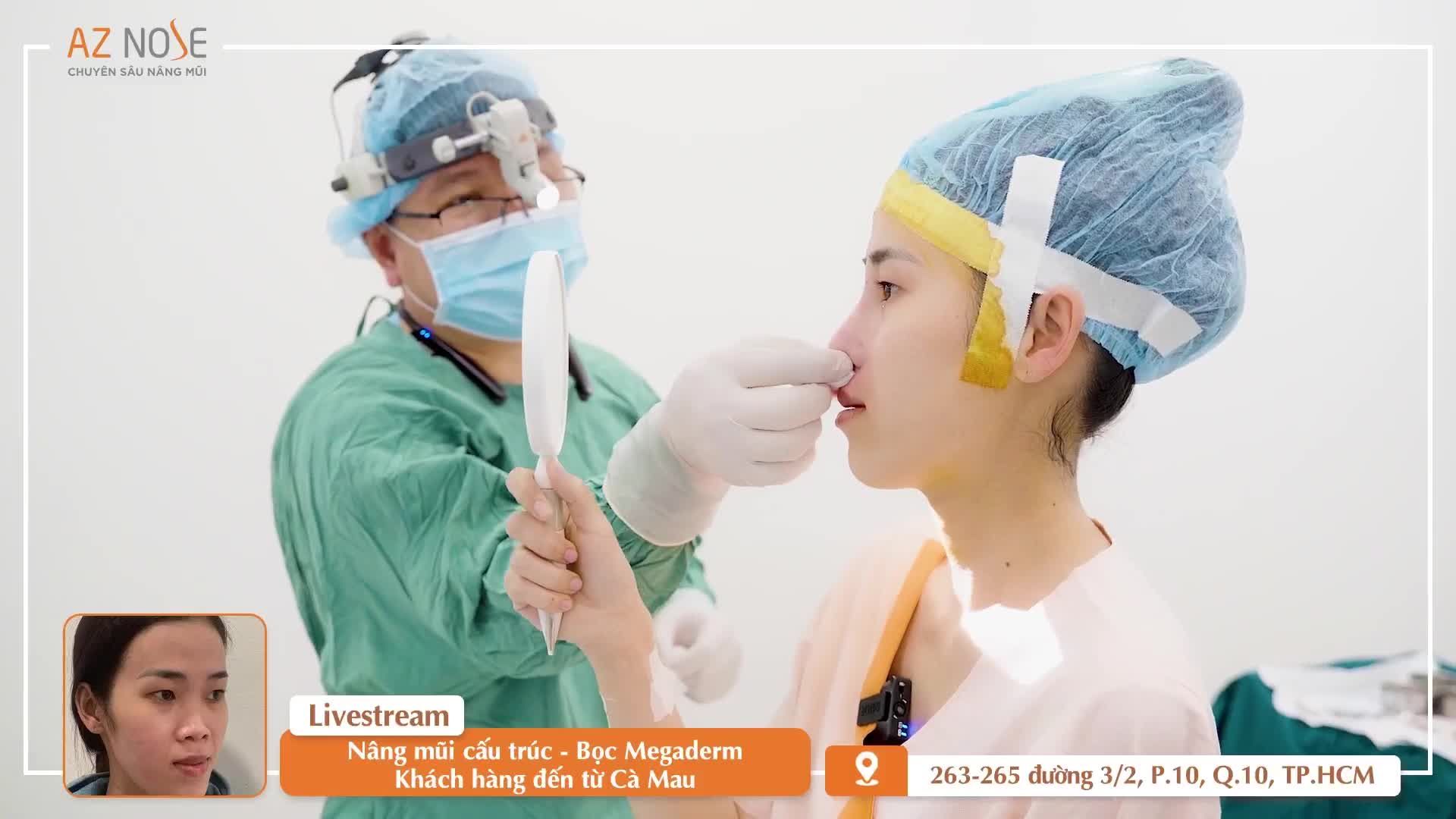 Khách hàng đến từ Cà Mau hài lòng với dáng mũi Sline cao
