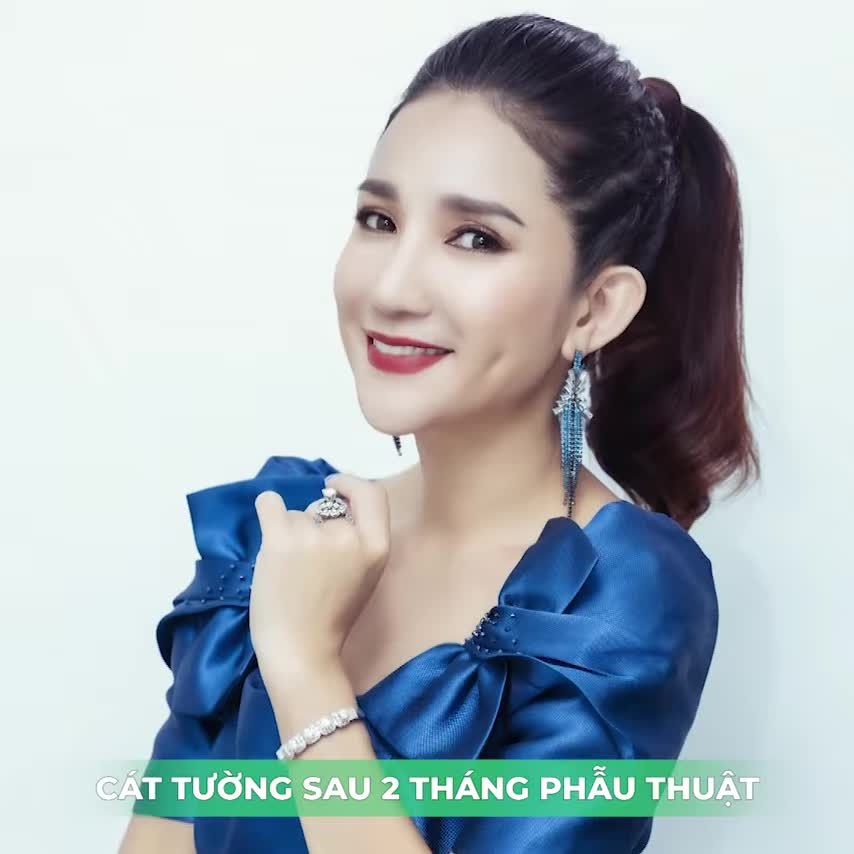 NSƯT CÁT TƯỜNG LỰA PHẪU THUẬT CĂNG DA MẶT NỘI SOI ENDOFACE – ƯU ĐÃI BỆNH VIỆN THẨM MỸ NAM AN ĐẾN 50%!!