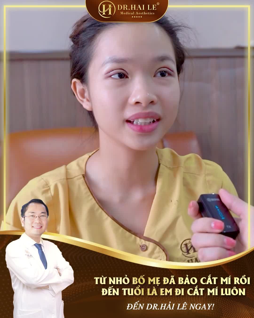 "Từ nhỏ bố mẹ đã bảo cắt mí rồi, đến tuổi là em đi cắt mí luôn!"