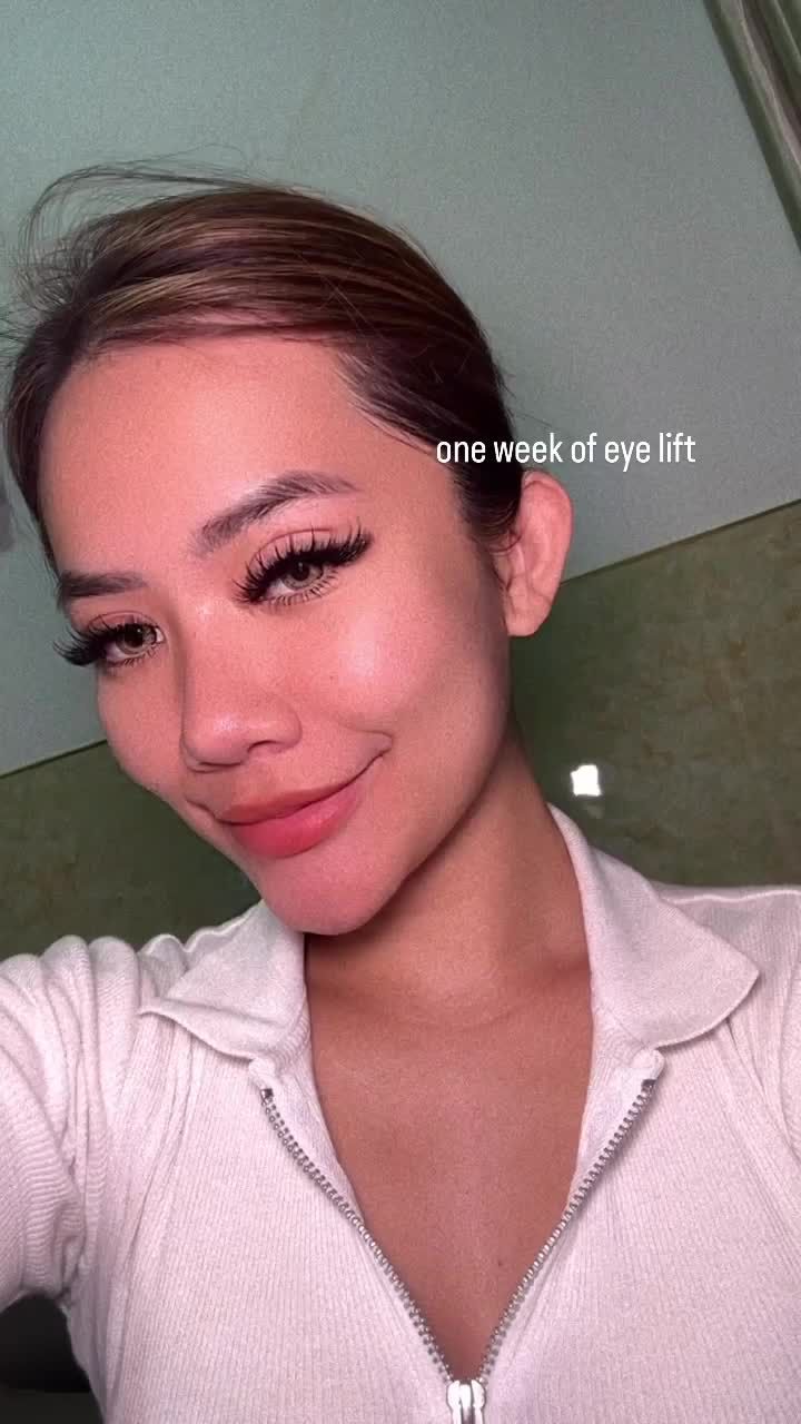 “ Feedback sau 1 tuần tạo hình mí mắt từ bạn hot girl Lucy xinh đẹp của “