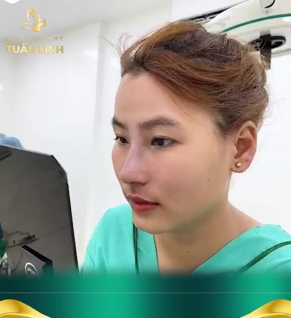 Đã từng nâng mũi nhưng bị: lộ sống, bóng đỏ, sống mũi thấp, đầu mũi ngắn hếch...