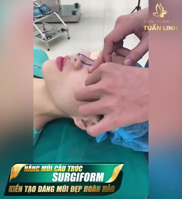 NÂNG MŨI CẤU TRÚC SURGIFORM - KIẾN TẠO DÁNG MŨI MỚI ĐẸP HOÀN HẢO!!!