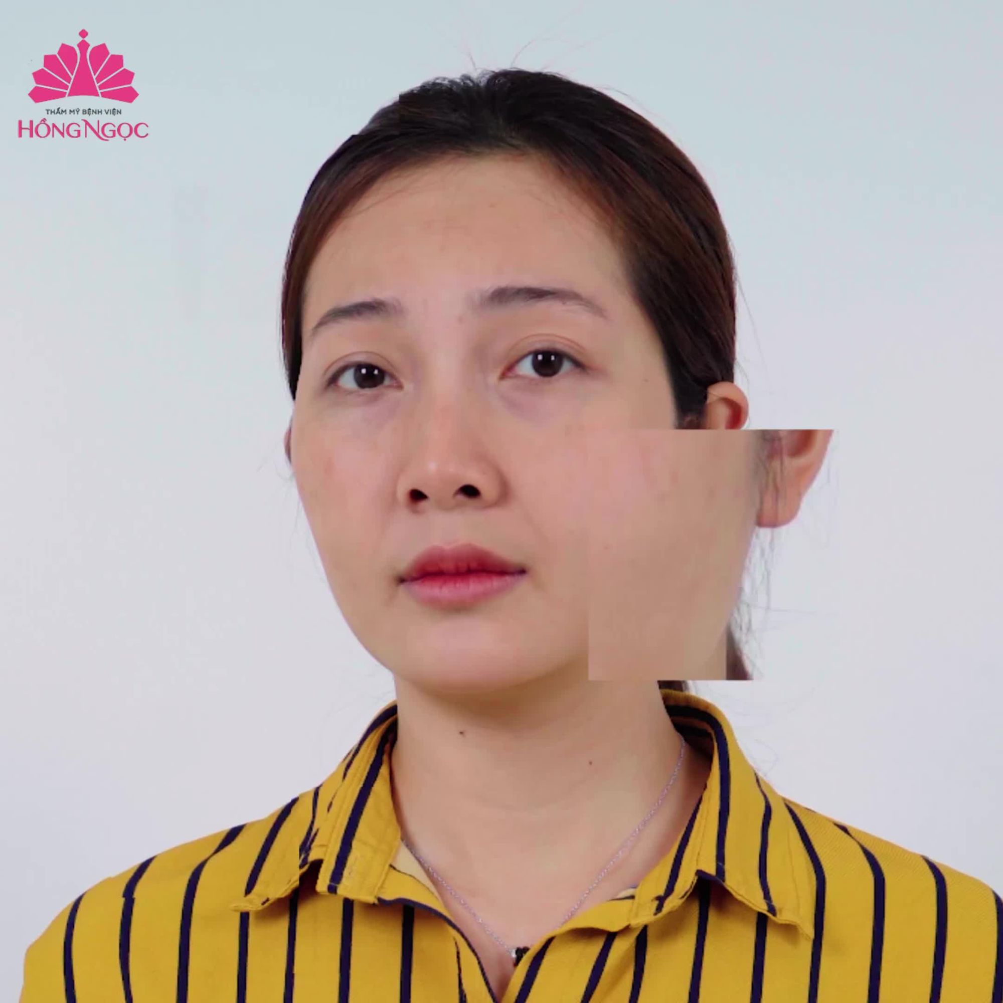 TRẺ RA 10T LÀ CẢM GIÁC NHƯ THẾ NÀO?
