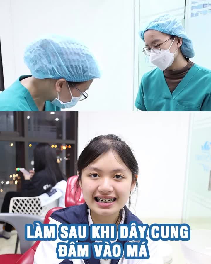 Khi niềng, dây cung đâm vào má thì phải làm sao?