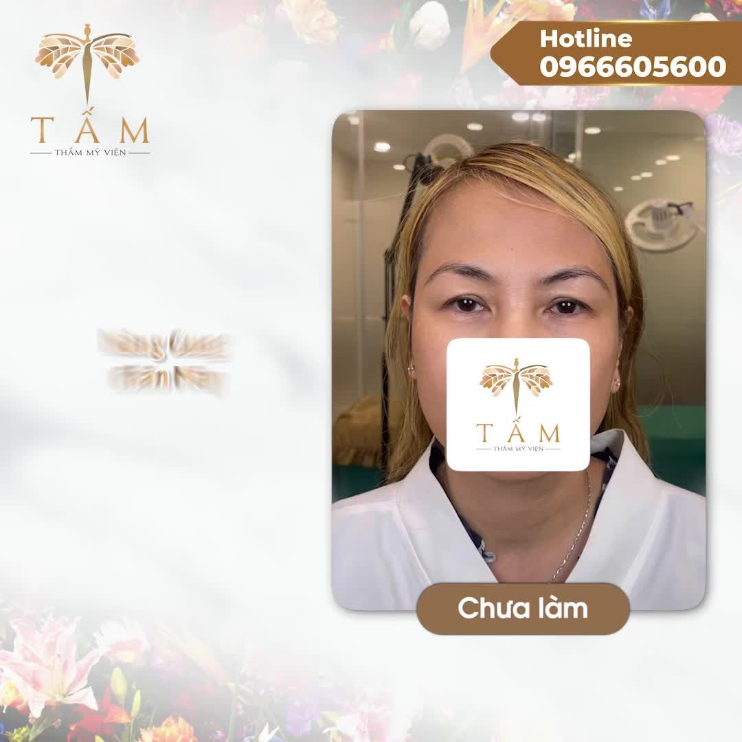 Bí kíp đơn giản giúp trẻ hoá đôi mắt là Nâng cung chân mày