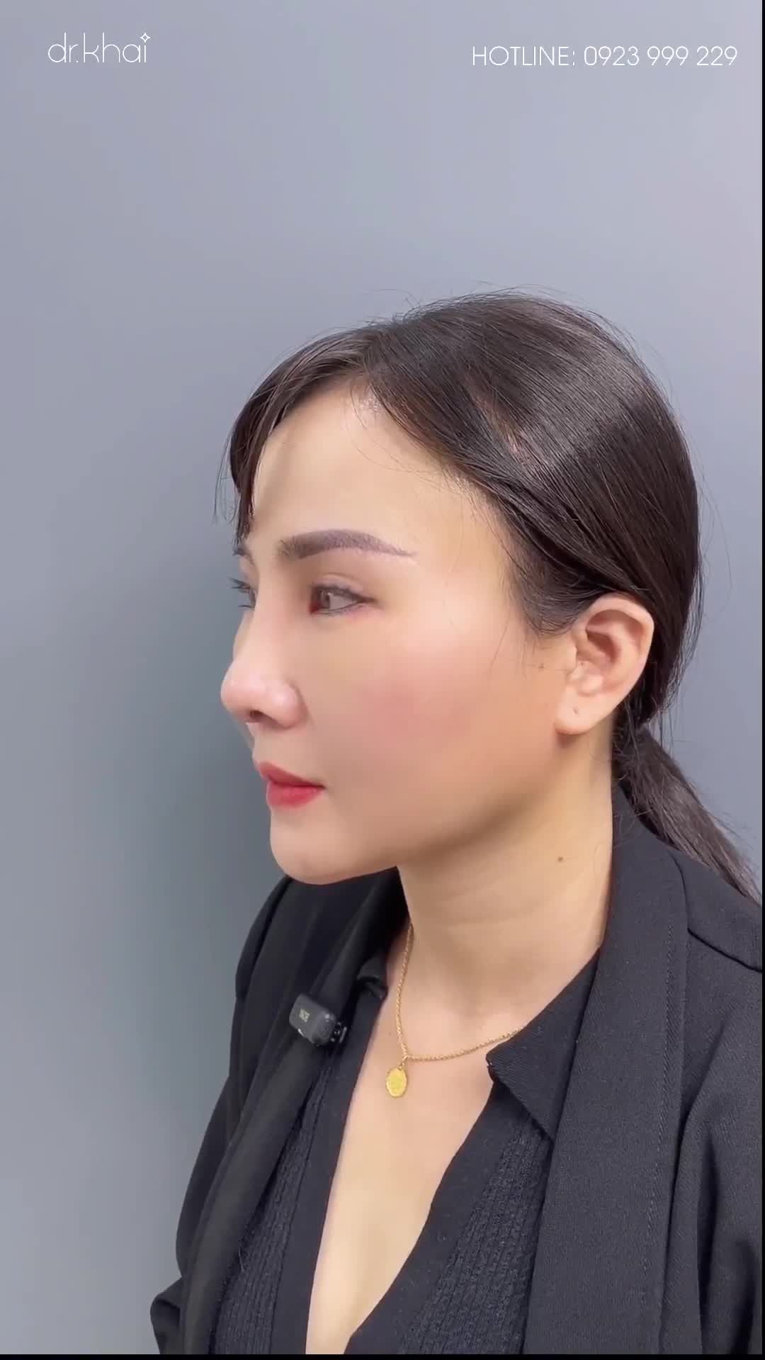 BẤT NGỜ TRƯỚC KẾT QUẢ CHỊ KHÁCH HÀNG VỚI SIÊU COMBO 200TR