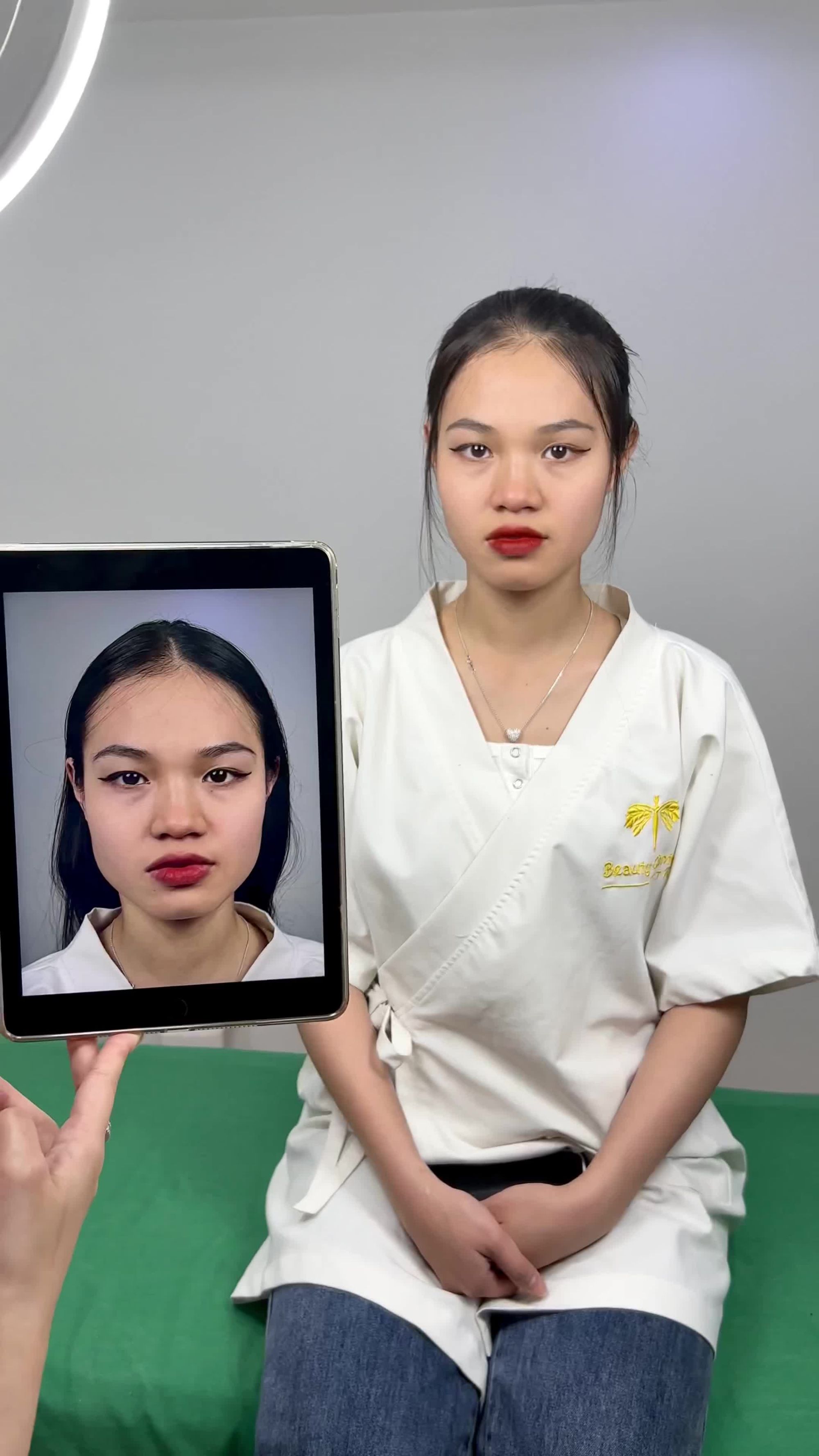Ca Vline Perfect quay lại tái khám tại TMV Tấm