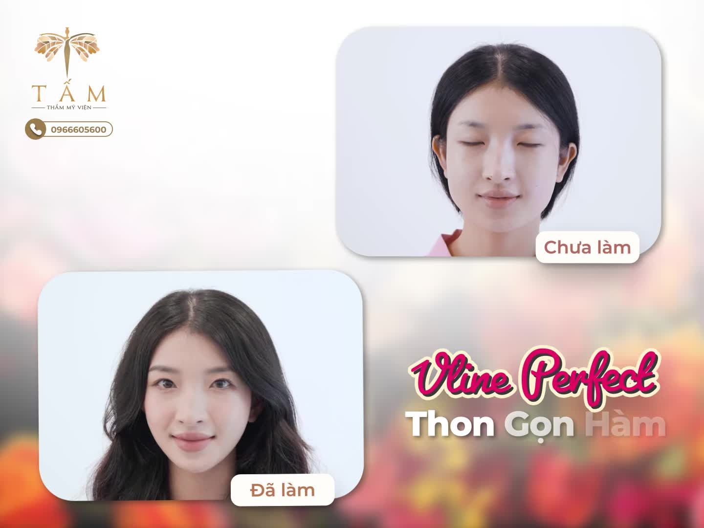 "ĐẸP LÀ MỘT ĐẶC QUYỀN CỦA PHỤ NỮ"