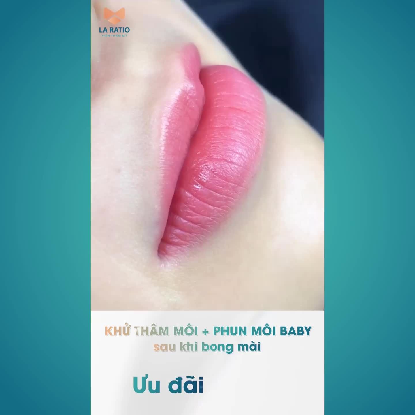 PHUN MÔI CÔNG NGHỆ ĐỘC QUYỀN - THAY SẮC CHO ĐÔI MÔI ĐẸP RẠNG RỠ