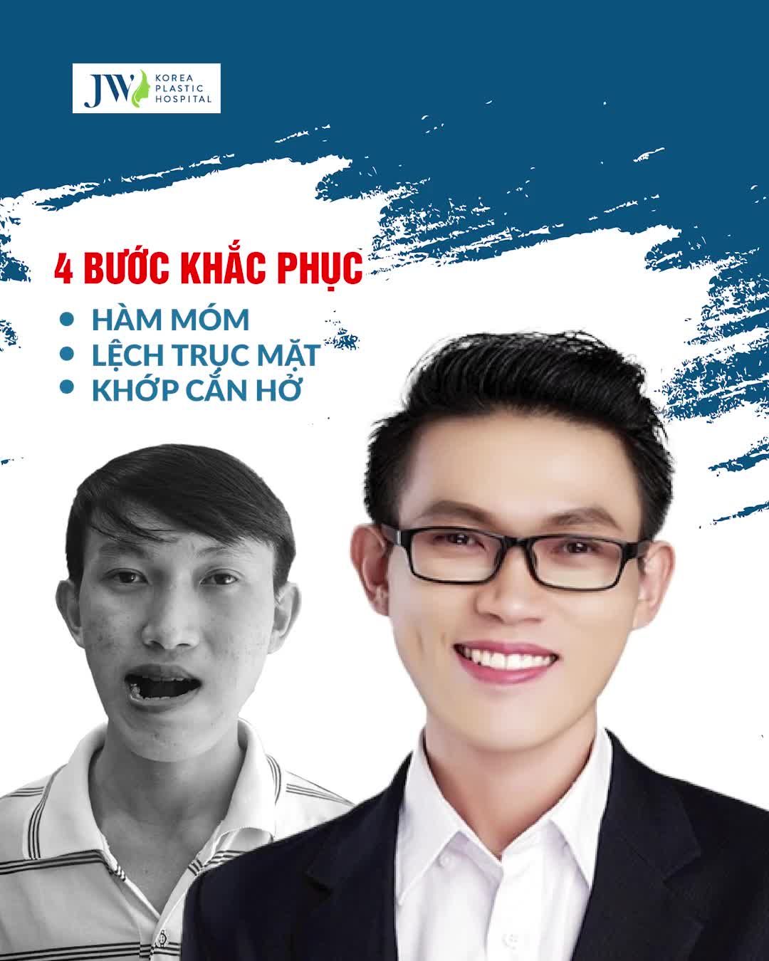 PHẪU THUẬT HÀM MÓM - BƯỚC NHẢY TỪ TỰ TI ĐẾN TỰ TIN