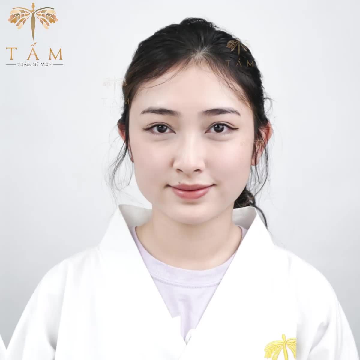 BẠN ĐÃ SẴN SÀNG BIẾN MẶT "U LINE" KÉM SẮC  MẶT "VLINE" THON GỌN XINH TƯƠI CHƯA