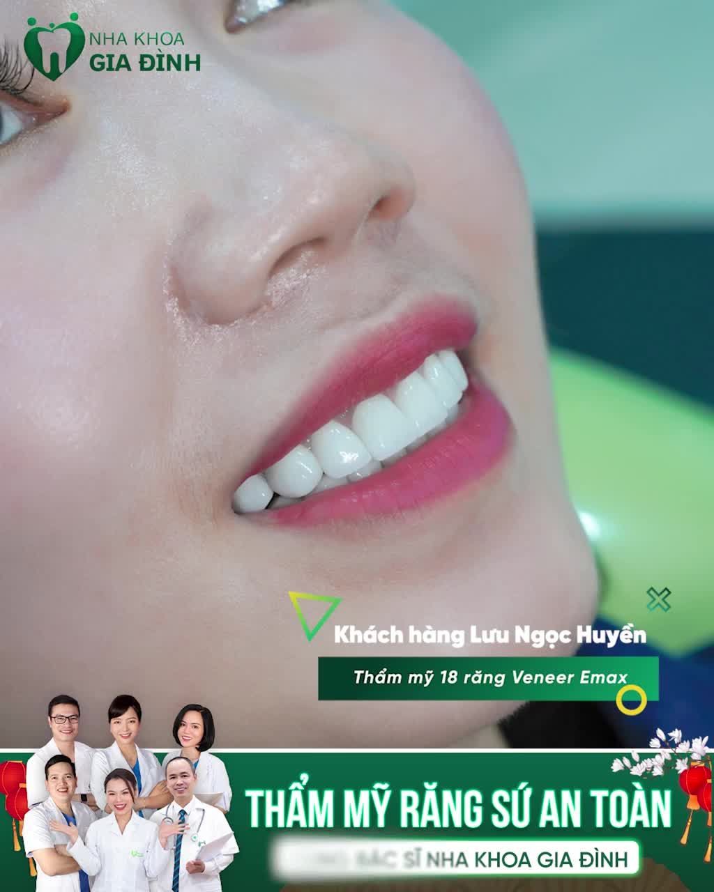 THẨM MỸ RĂNG THAY ĐỔI CẢ MÀU SẮC LẪN HÌNH DÁNG RĂNG MỘT CÁCH HOÀN HẢO