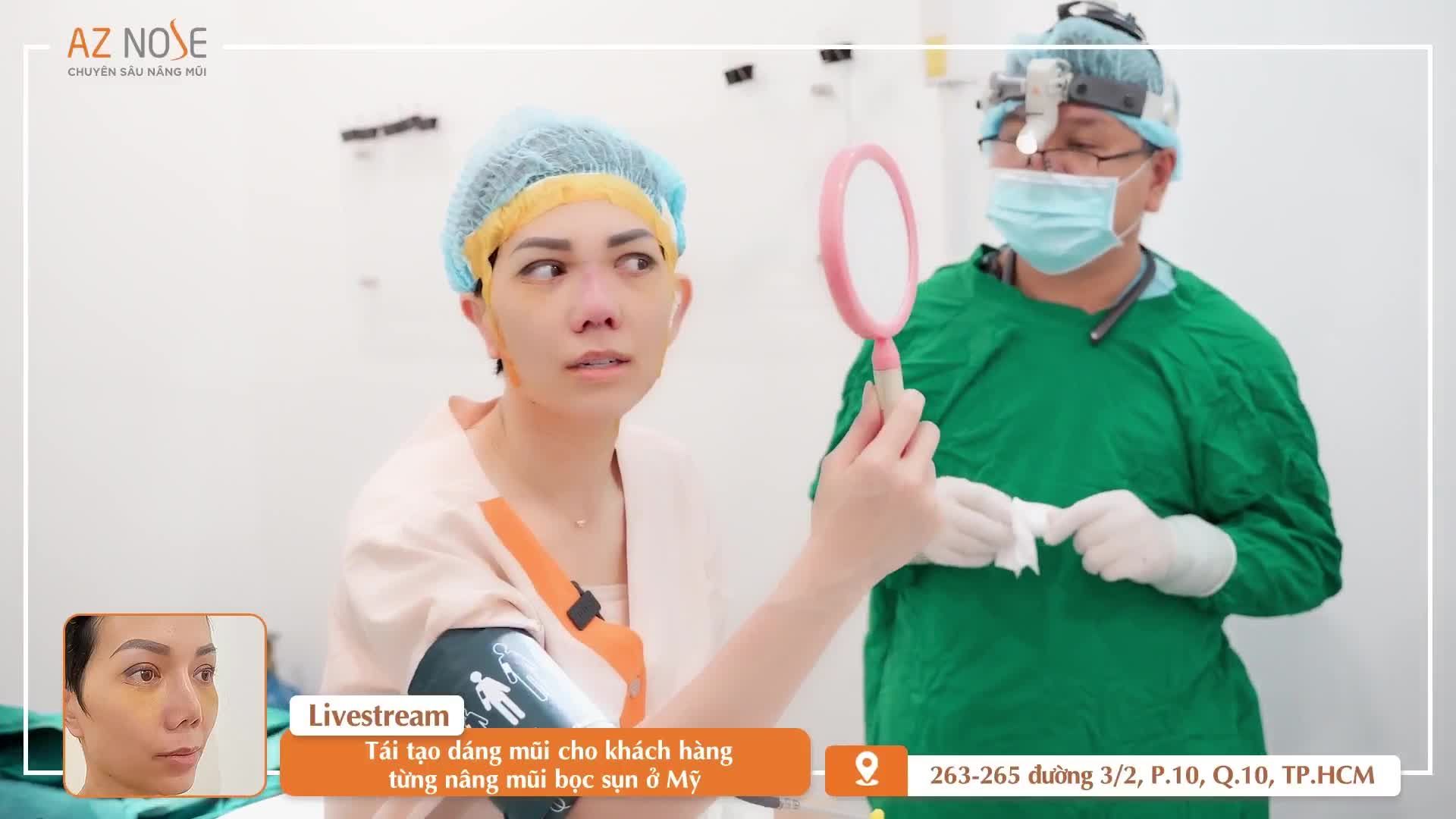Khắc phục mũi ng.ắn cho khách hàng 8X từng nâng mũi tại Mỹ