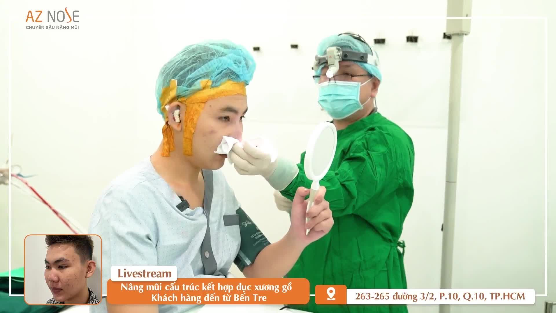 Khắc phục mũi ng.ắn với phương pháp cấu trúc sụn tai