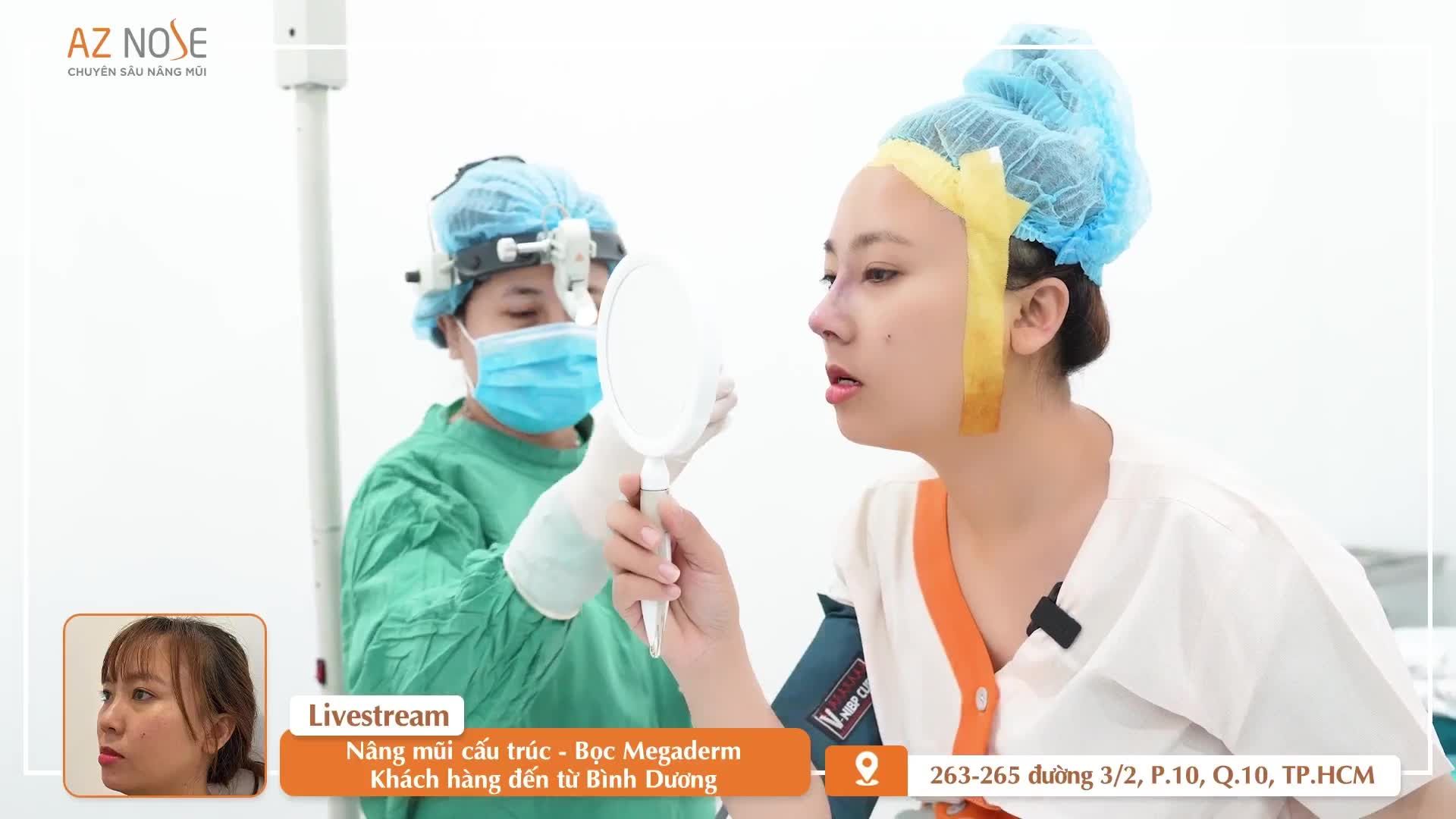 Dáng mũi cao trẻ trung cho khách hàng 9X từng ti.êm filler