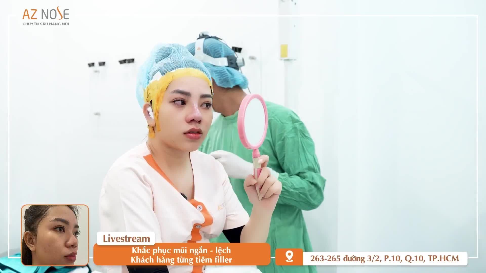 Khắc phục mũi ng.ắn, l.ệch cho khách hàng 9X từng t.iêm filler