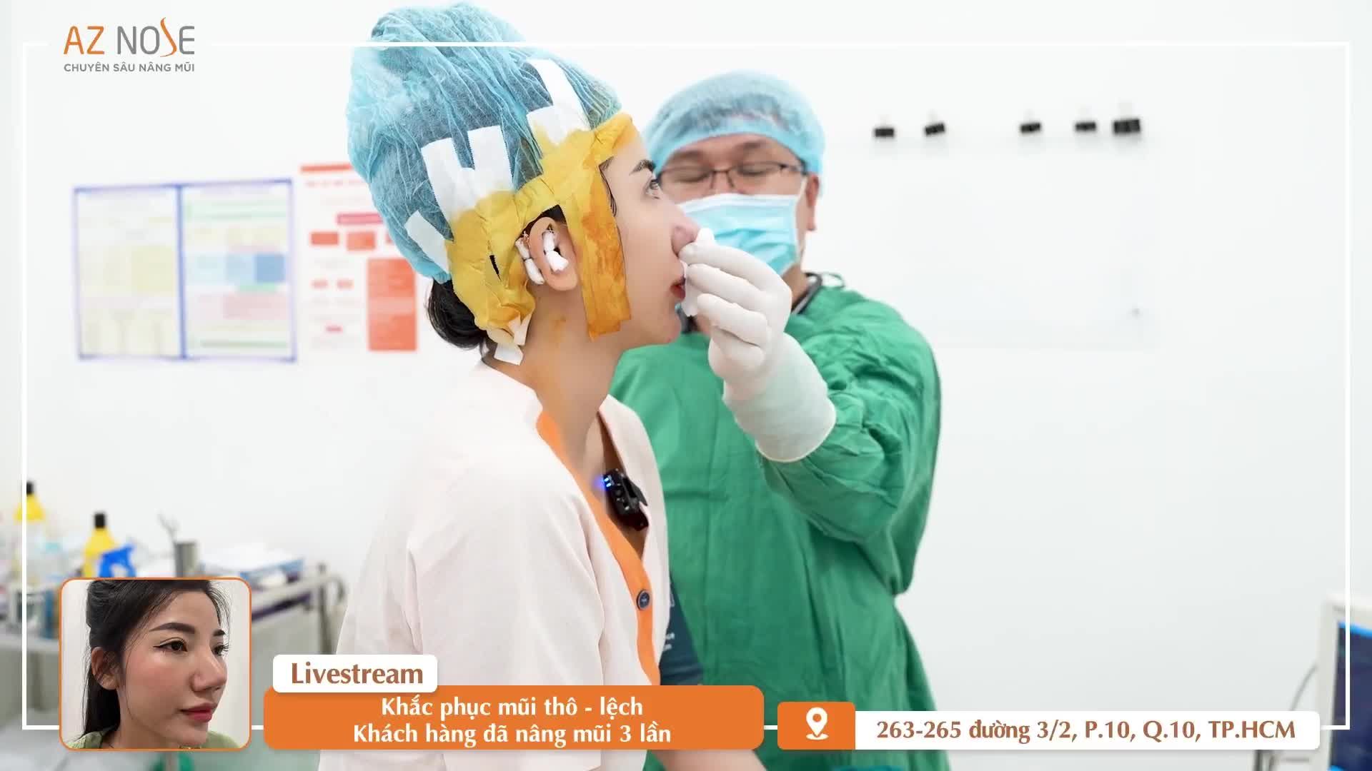 Bác sĩ Hoàng Nam tái tạo mũi h.ỏng cho khách hàng đã 3 lần nâng mũi