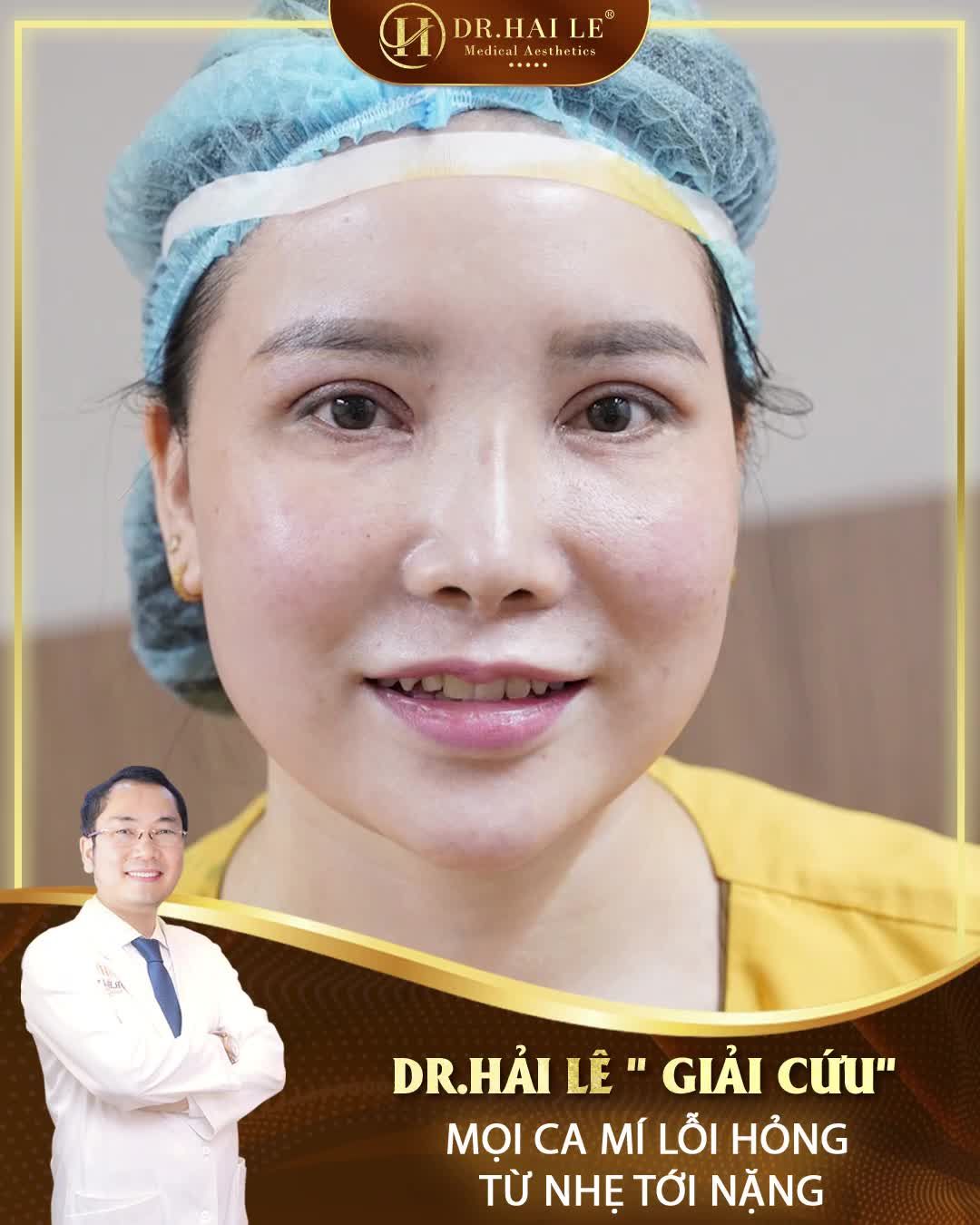 Dr.Hải Lê "giải cứu" mọi ca mí lỗi, hỏng từ nhẹ tới nặng. Có thật NHƯ LỜI ĐỒN?