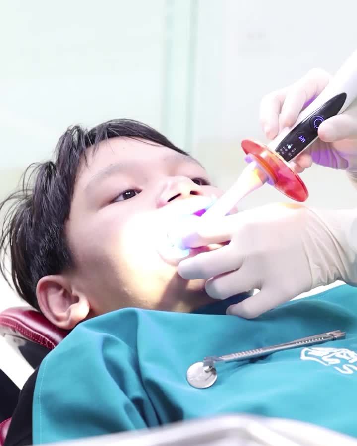 Niềng răng không đặt thun tách kẽ có được không?