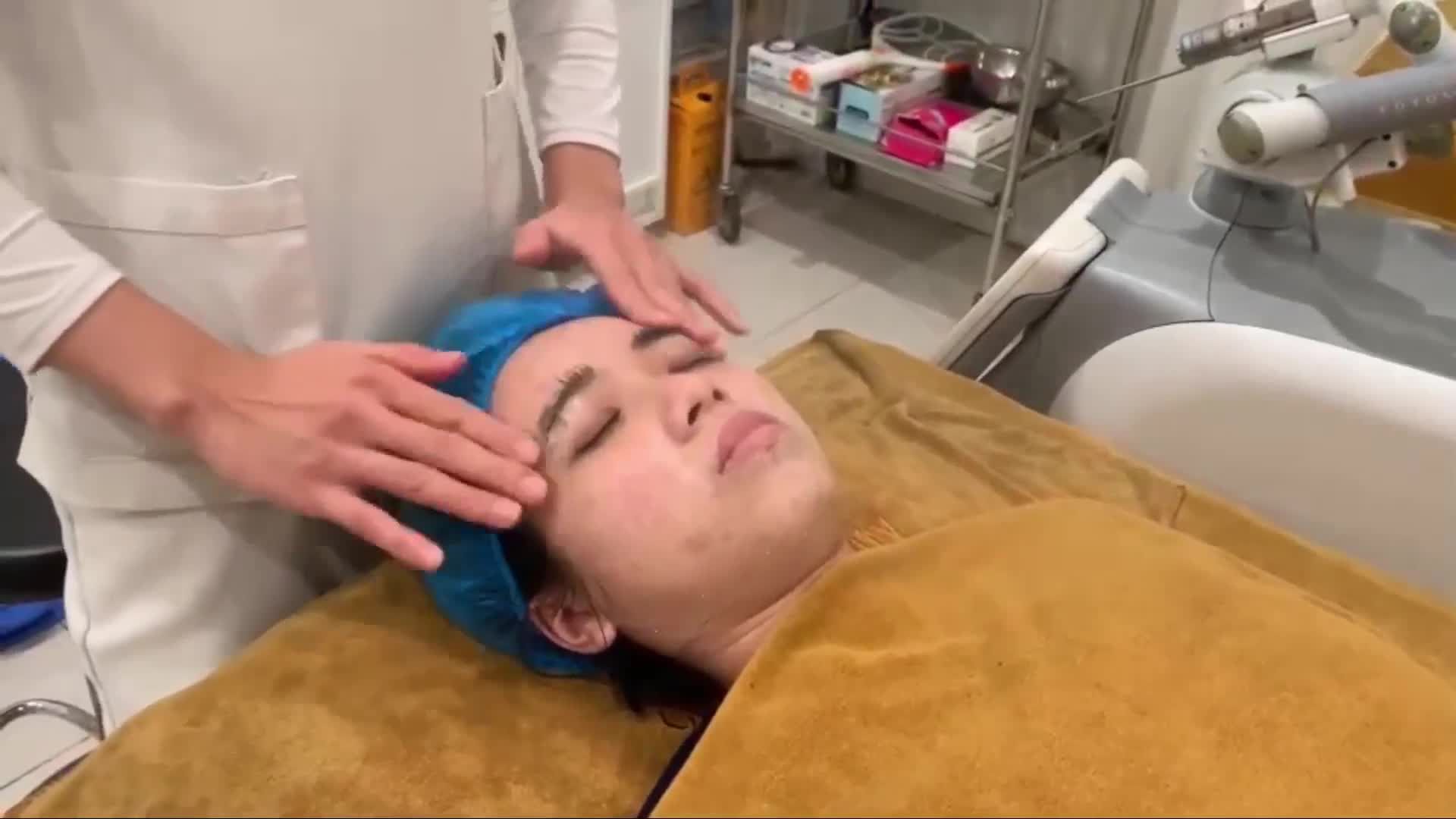 Điều trị mụn tại Thẩm mỹ DrD - Hiệu quả rõ rệt sau 1 liệu trình.