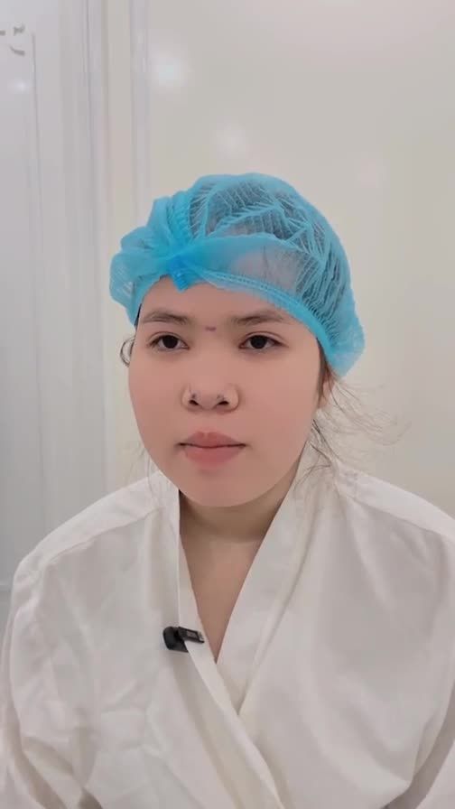Cảm nhận của chị khách hàng đến từ Vĩnh Long trước khi nâng mũi cấu trúc