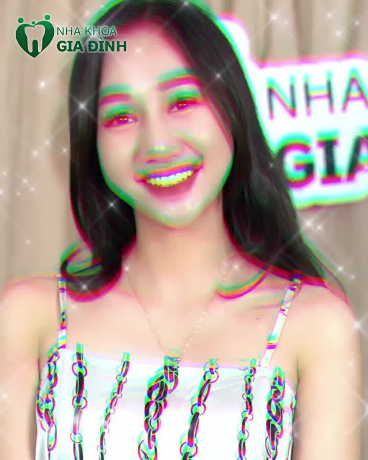 LÀM RĂNG SỨ CÓ ĐAU NHƯ LỜI ĐỒN?