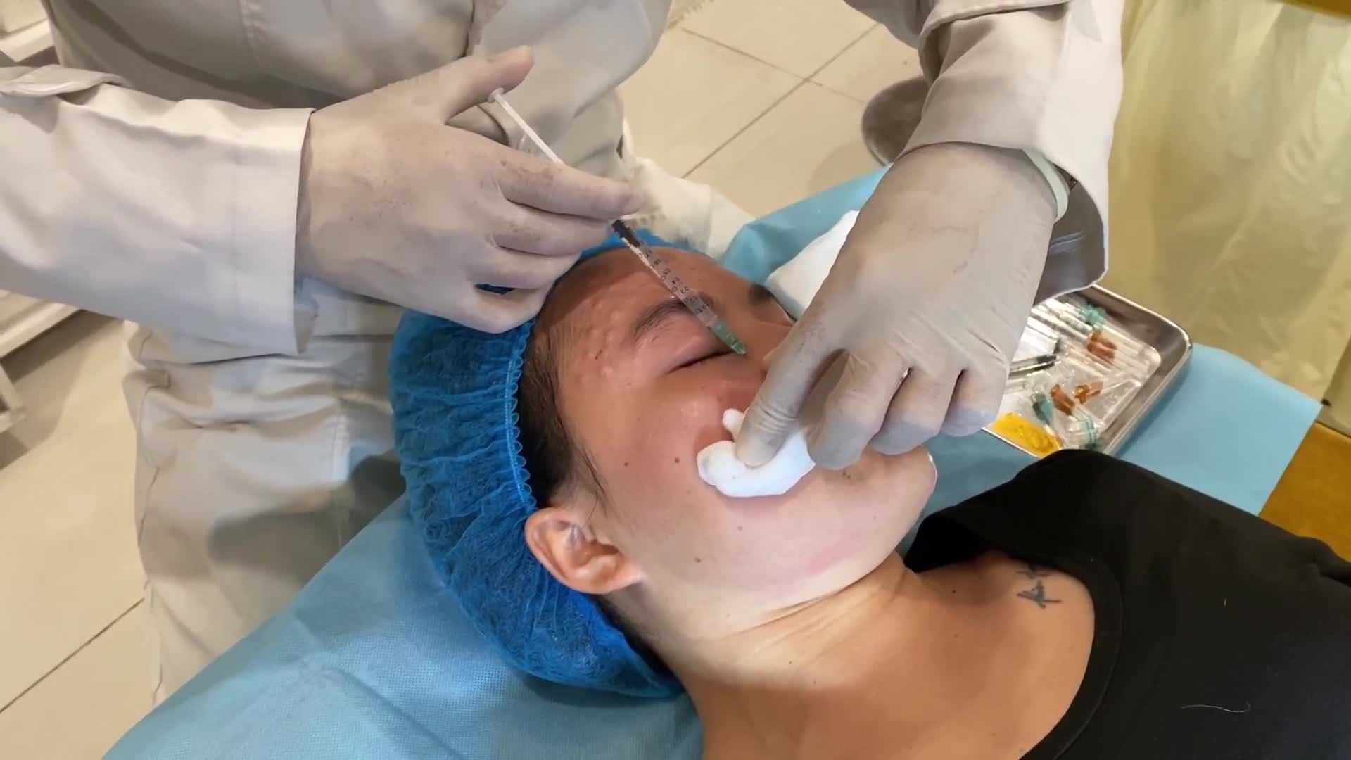 Cận cảnh bác sĩ tiêm Mesotherapy cấp ẩm, giúp da trắng sáng, căng mọng.