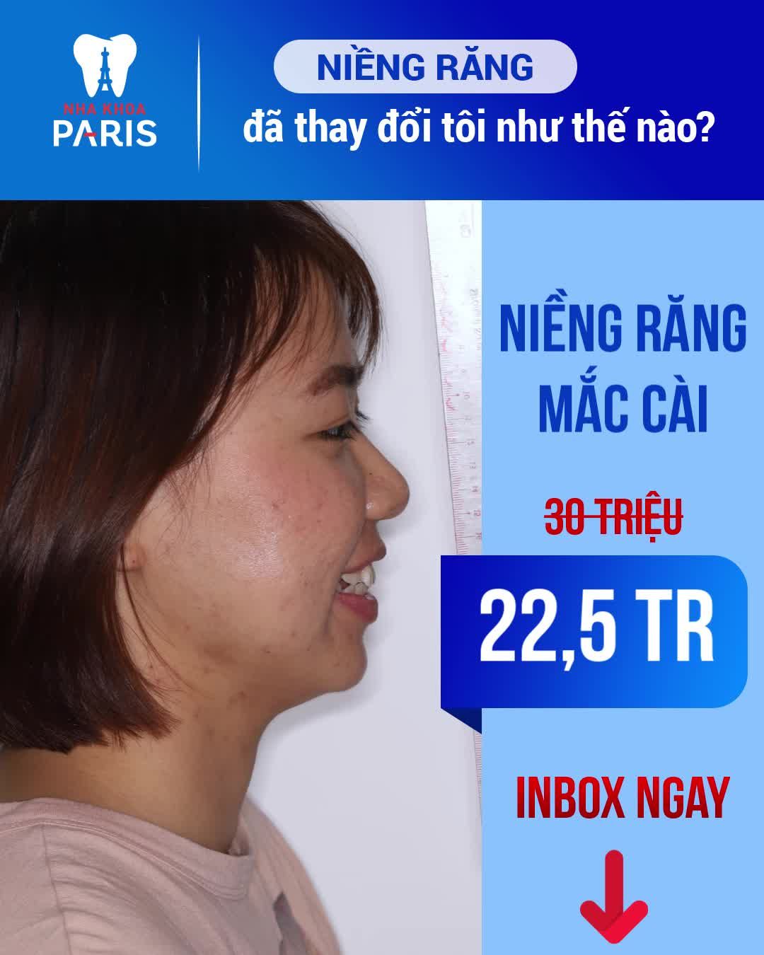 Niềng Răng Mắc Cài Chính Hãng