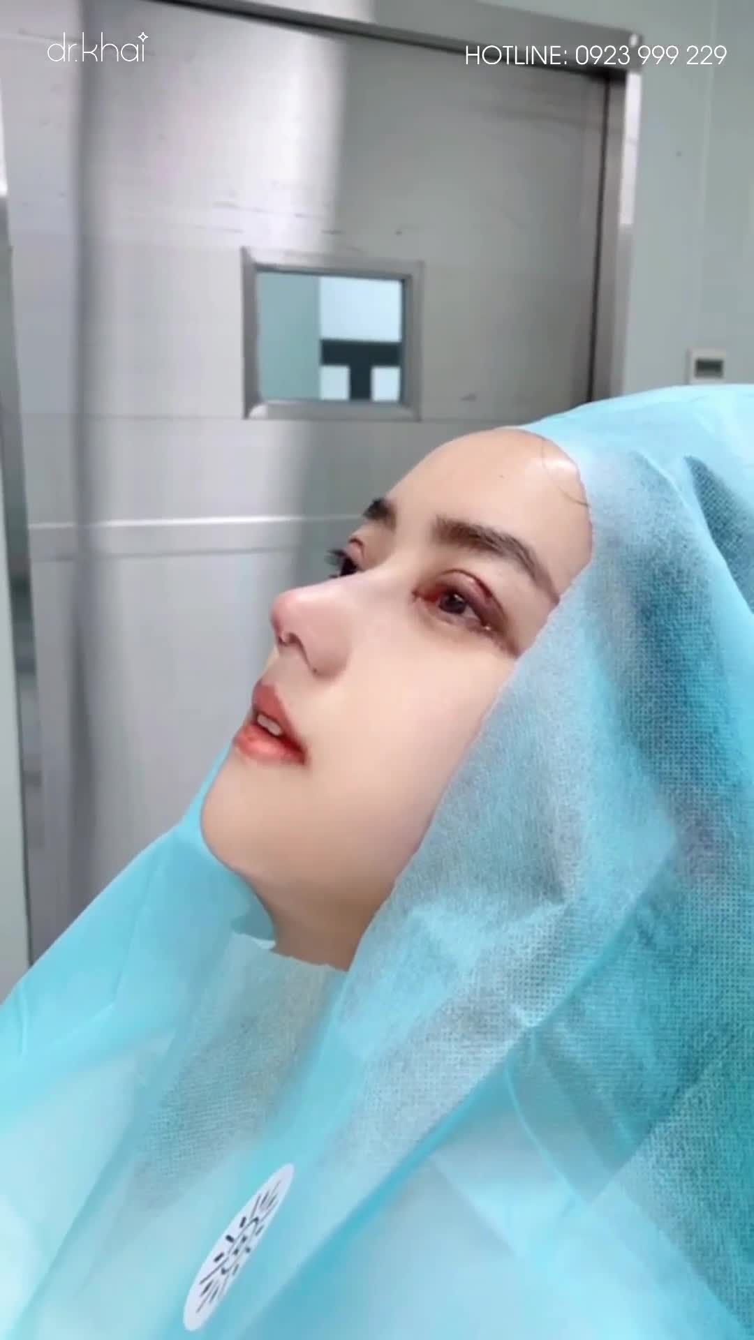 THAY ĐỔI NGOẠN MỤC SAU NÂNG MŨI, MÀI GỒ, CẮT MÍ, MỞ GÓC MẮT TRONG