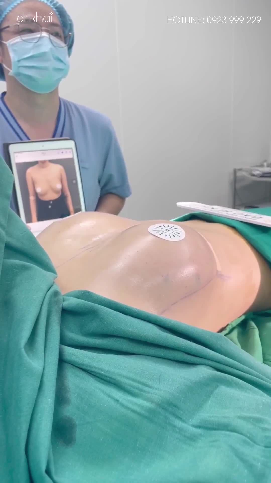 CẢI THIỆN VÒNG 1 THẤP, XỆ CHO KHÁCH HÀNG CHƯA SINH CON