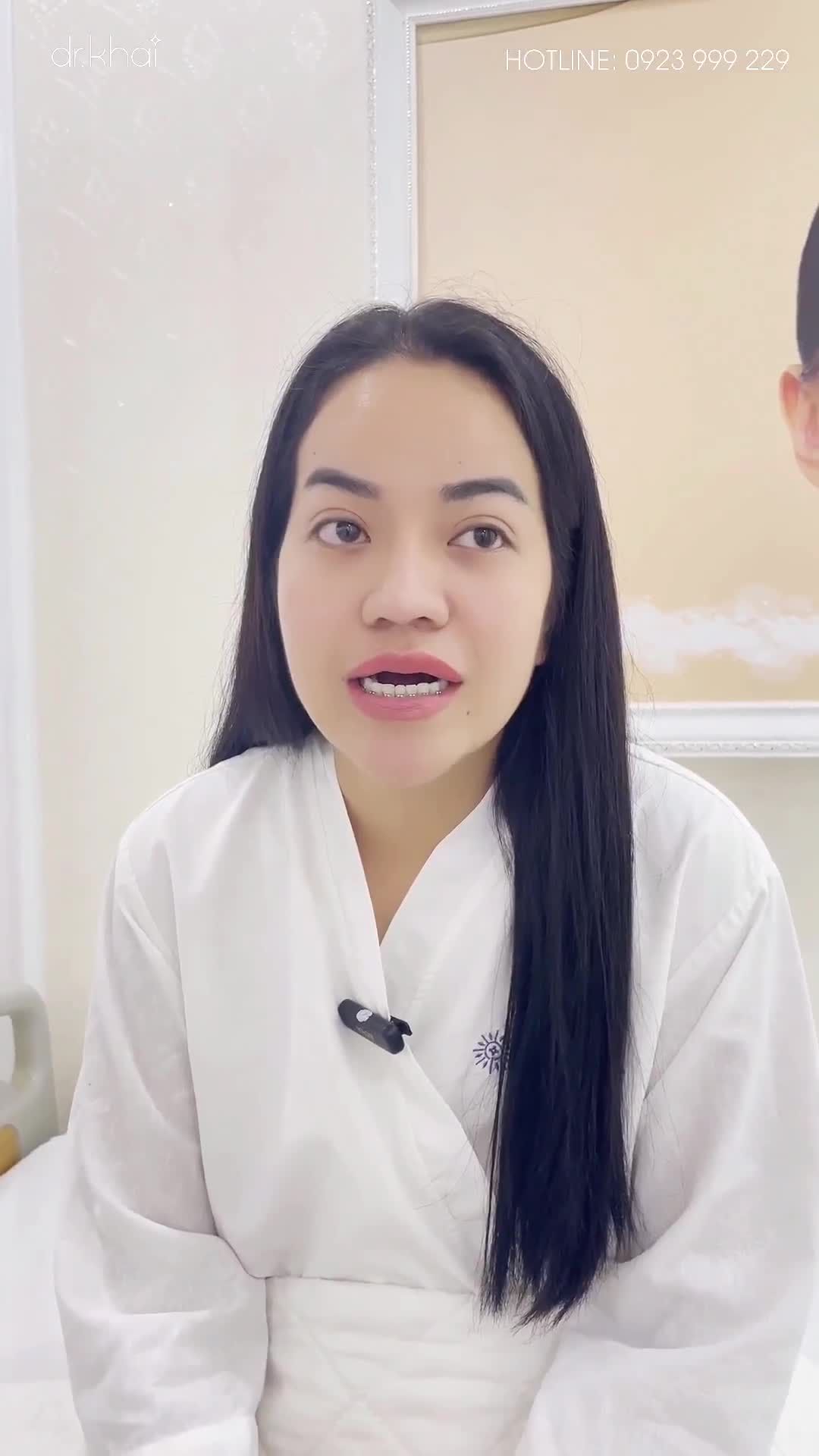 SỬA LẠI MŨI BỊ LỘ SỤN SÓNG